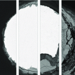 Zinc Bioabsorbable Stent