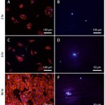 Fluorescent imaging of HAEC 